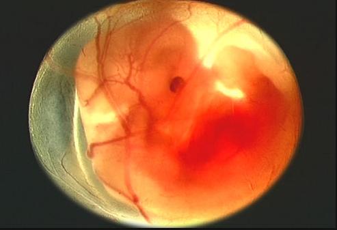 从怀孕一个月到怀孕十月，每个月胎儿的发育图都在这里了，真全