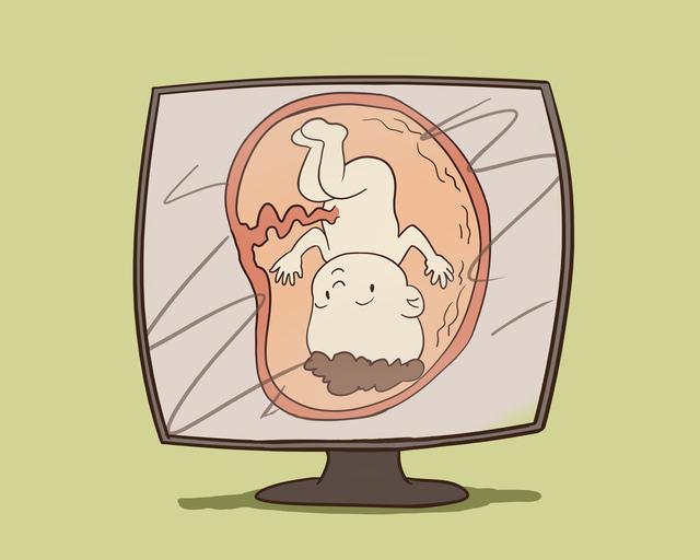 辟谣，屁股大就好生养？其实关键要看这几点