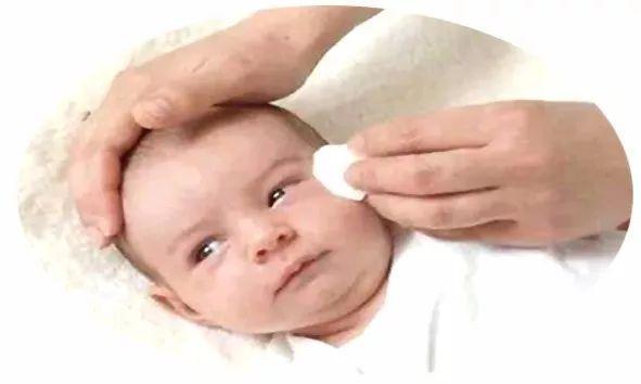 宝宝总是“泪汪汪”，家长应当心新生儿泪囊炎