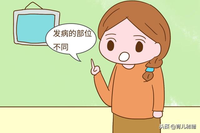 湿疹、小儿急疹、痱子长得太像分不清？这几个区别能帮到你