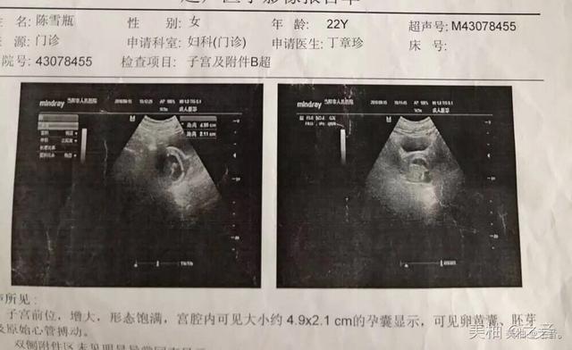 四维顺利通过，确认男宝一枚，附上孕期特征，没生的进来