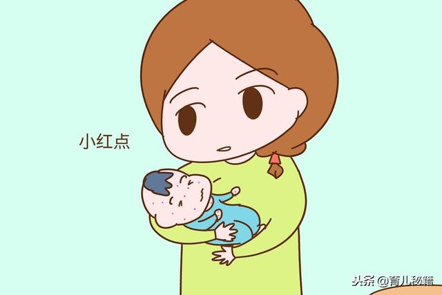 湿疹、小儿急疹、痱子长得太像分不清？这几个区别能帮到你