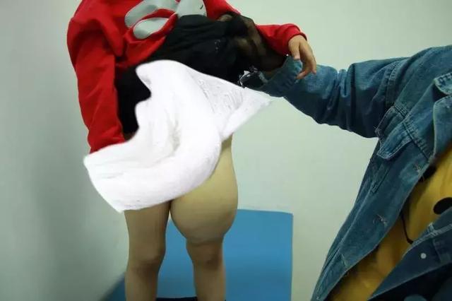 左腿比右腿粗三倍！小女孩出生4年，没穿过裤子！
