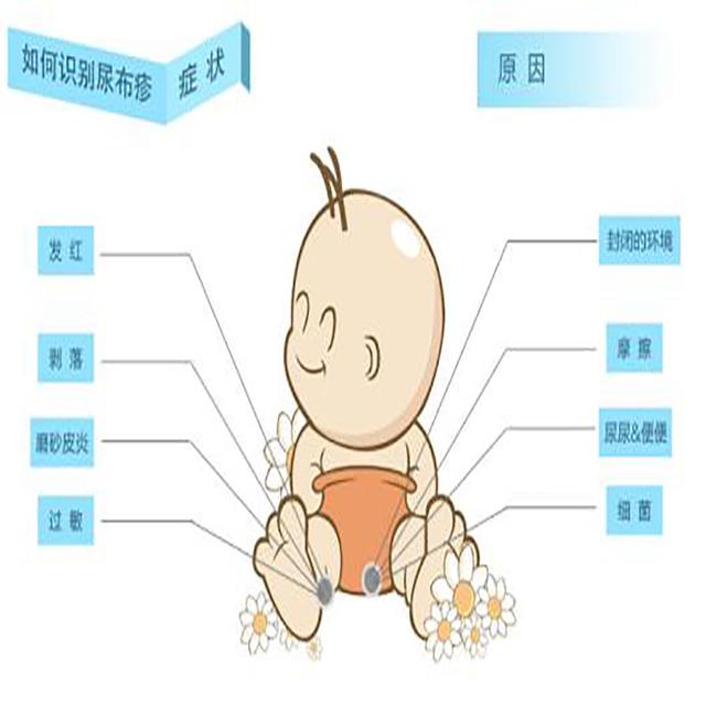 是什么导致宝宝红屁股？如何避免？一定要注意这五大方面，错不了