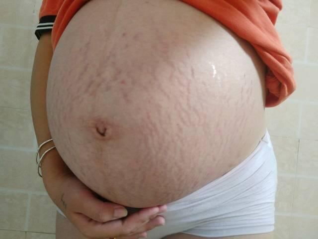 二胎宝妈没在意，肚子太大六个月才去产检，医生怒怼：早干嘛去了