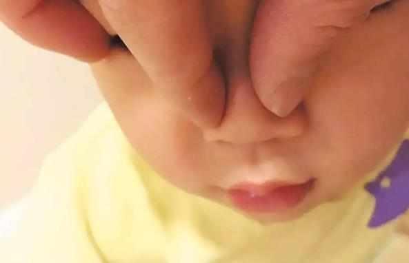 辟谣：宝宝鼻子塌，捏一捏就能变成高鼻梁？错，可能会引发中耳炎