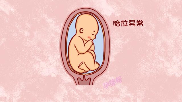 符合这3个条件的孕妈，只能选择剖宫产，但愿其中没有你！