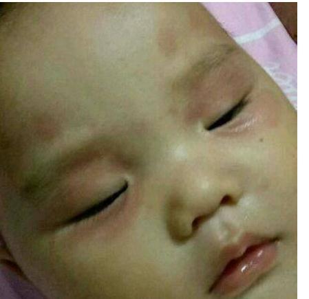 奶奶为让宝宝有双眼皮，用针扎宝宝眼睛，母亲冲上去就是一巴掌