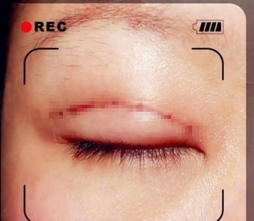 奶奶为让宝宝有双眼皮，用针扎宝宝眼睛，母亲冲上去就是一巴掌