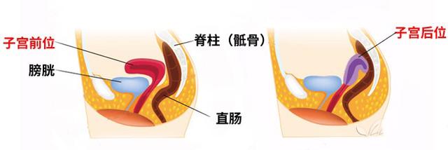 子宫的位置，会影响怀孕？如果你听说过“倒立术”，更应该看看