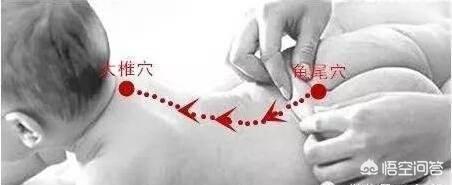 小儿捏脊是否需要每日进行？为什么呢？