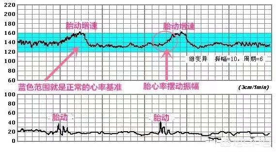几个月时做胎心监护比较好？前面检查都是正常的孕晚期还有必要检查吗？