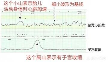几个月时做胎心监护比较好？前面检查都是正常的孕晚期还有必要检查吗？