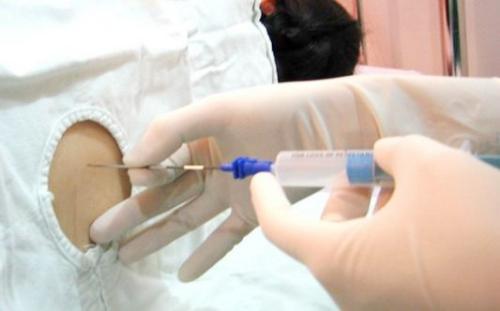 七张图详解剖腹产手术全过程,女人有多伟大,每个男人都该看看