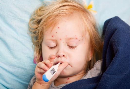 秋冬也是宝宝“手足口病”的高发期，做好预防工作，家长别懈怠