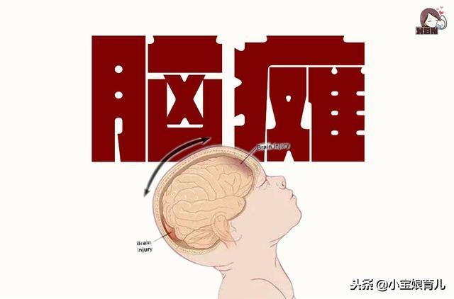 新生儿脑瘫的4个早期症状是什么？5个预防措施或能避免！