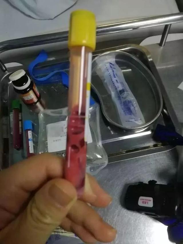 17岁少女腹痛差点丢命！血液变粉红，孩子这个习惯家长一定要注意