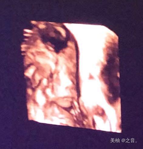 留级4天，顺产7斤胖小子，分享最全孕期症状，进来接吧都能中