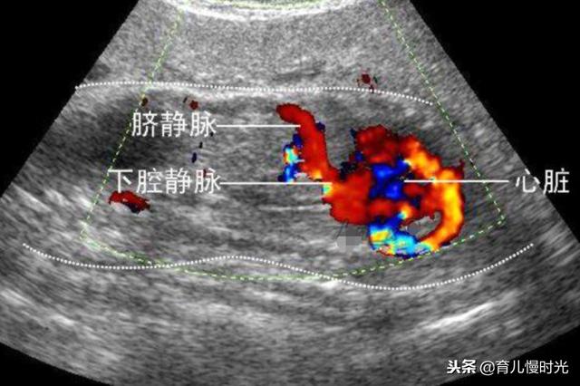 孕期四维是必查项目吗？彩超B超三维与四维有什么关系？