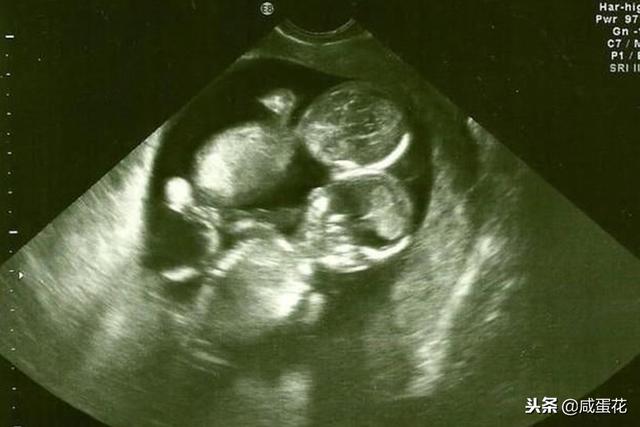 做到这几点，想不怀上双胞胎都难！