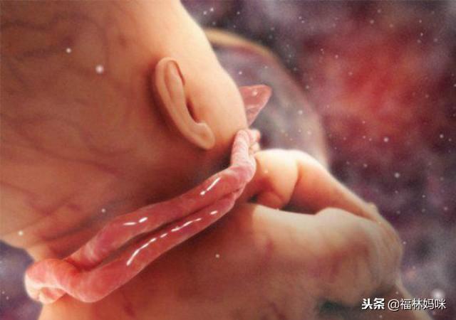 胎儿脐带绕颈孕妈有感觉吗？想要顺利生产，孕期得注意这3点