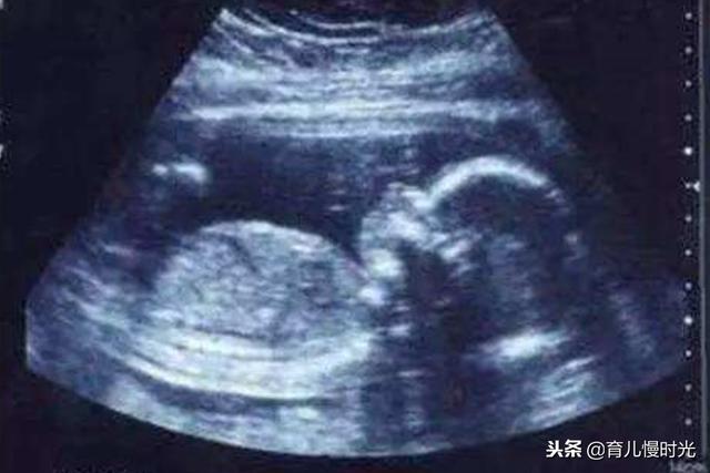 孕期四维是必查项目吗？彩超B超三维与四维有什么关系？