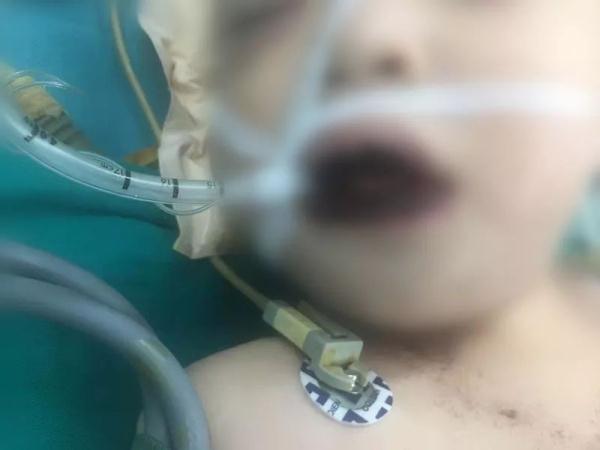 这种“糖”能致死！医院曝光抢救经历为所有人敲响警钟