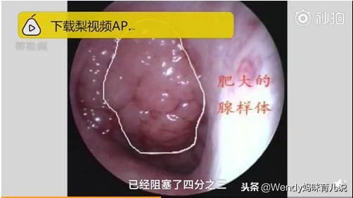又一孩子长残了！这种方法已鉴别100万人，再忙也要学！