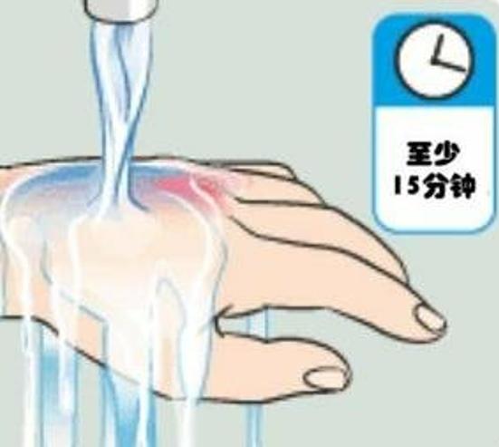 孩子被烫伤后留给你处理的时间只有2分钟，你知道怎么做吗