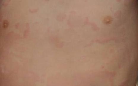 带4岁儿子出门逛街，路人们纷纷躲避，母亲看后心碎了