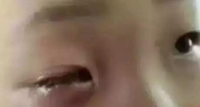 孩子眼珠被溶化……这东西你家也有，家长要警惕！