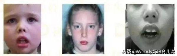 又一孩子长残了！这种方法已鉴别100万人，再忙也要学！