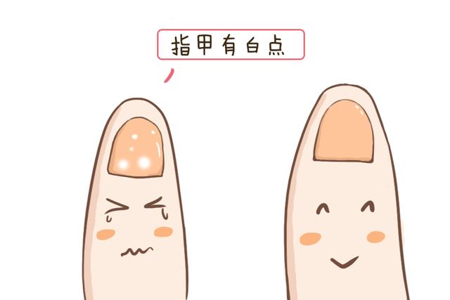 辟谣：宝宝指甲上有白点是因为肚子里有虫吗？原因没准是这样的！
