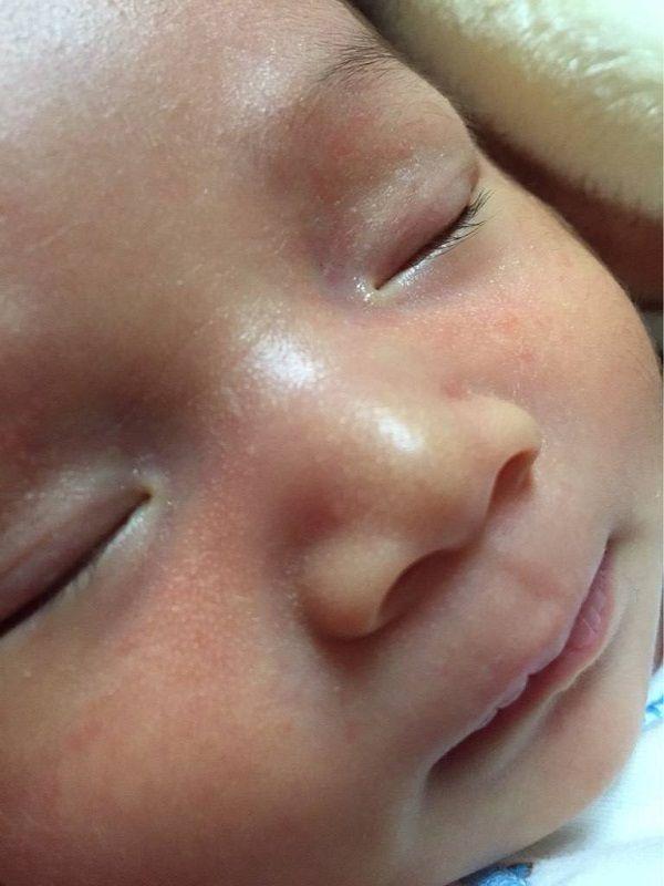 辟谣！捏鼻梁不仅不会让孩子鼻梁变高挺，反而会引发其他疾病