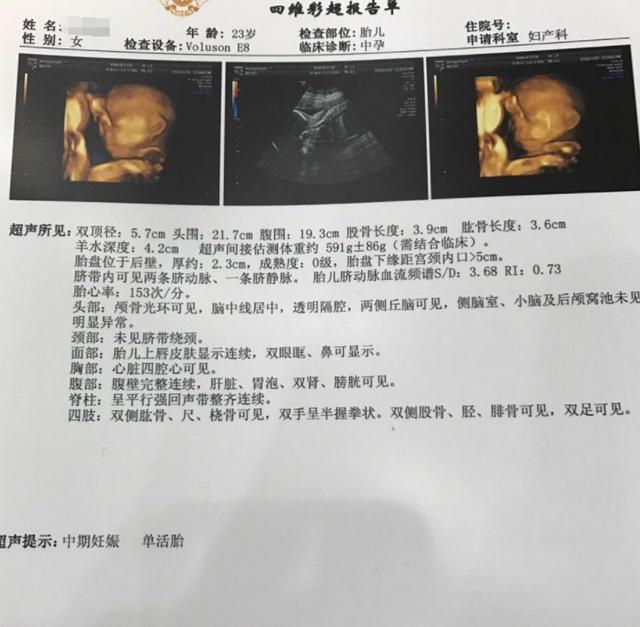 为什么大排畸放在孕中期？孕晚期检查的不是更清楚吗，原因不简单