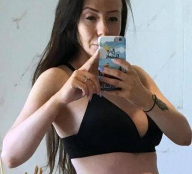 女子减肥过度患上厌食症，体重剩下50斤，如今生下一子！