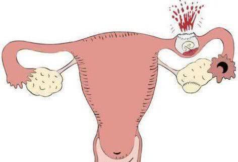 孕妇早产常见的10大原因，孕妈不能忽略的10个健康问题