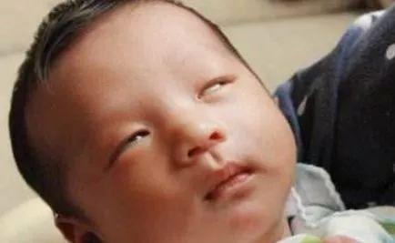 刚出生2个月宝宝总翻白眼，宝妈担心，医生检查后？