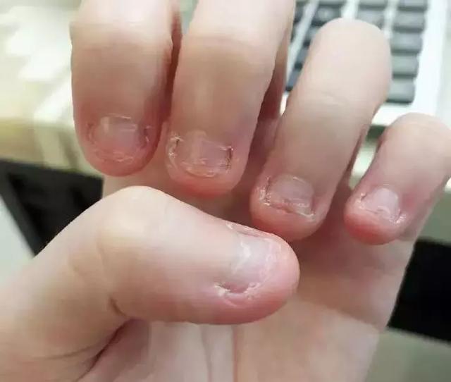 啃指甲、吃手、咬铅笔……孩子小动作背后暗藏心理问题，要警惕
