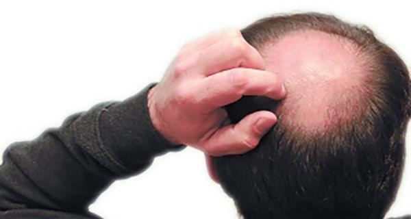 爸爸容易遗传给孩子的特征有哪些？有一项传男不传女