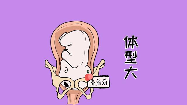 顺产不是所有人都可以的，如果有这3种情况的产妇，还是剖腹产吧