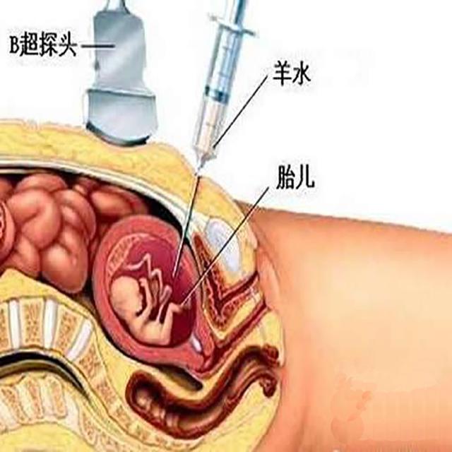 孕育指南：50岁的女人，还有生育能力吗？岁数大生孩子有啥风险？