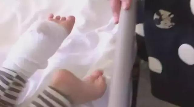 爸爸一个小动作，2岁女儿腿骨断成好几截！正要截肢……