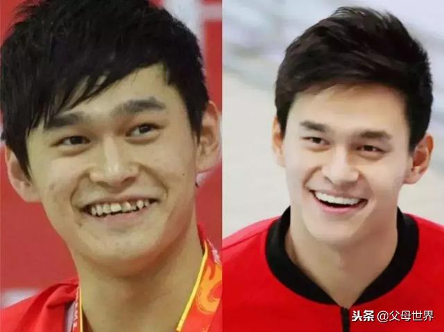 牙齿畸形和雾霾有关？儿童正畸专家解答牙齿矫正的16个热点问题！