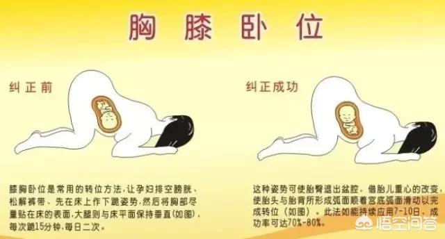 什么时候检查胎位正不正？