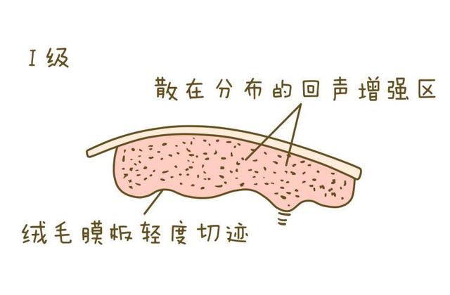 胎盘成熟度、胎盘厚度、预防胎盘老化，孕妇想知道的都在这里