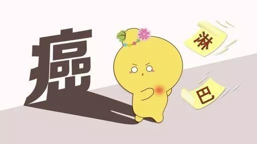 淋巴结肿大，离淋巴瘤还远吗？