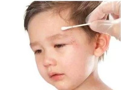 宝宝不小心磕碰受伤，伤口这样处理，才能防感染，少受罪，不留疤
