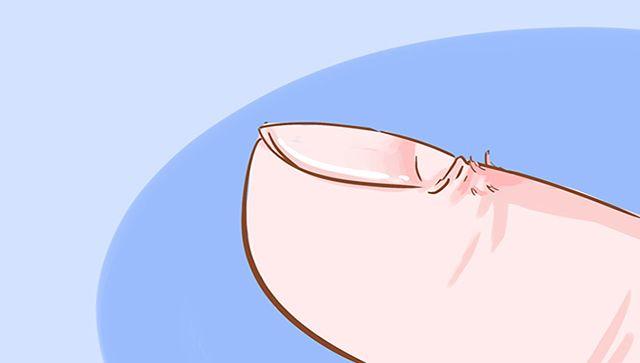 为啥有的宝宝会把自己抓伤，他不知道疼吗？