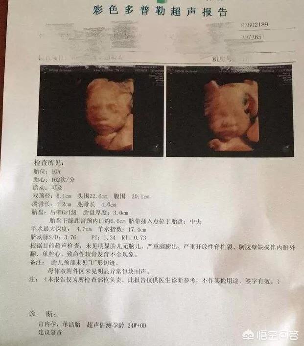 孕妇在孕期里一般要做几次四维？